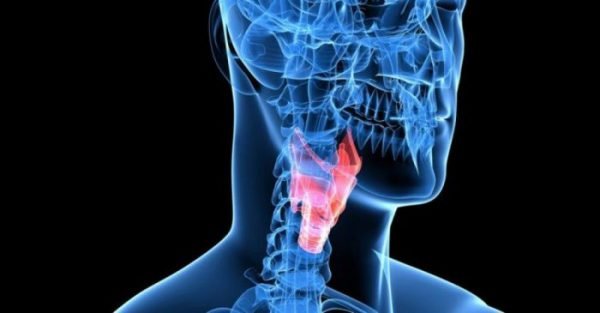 A laryngectomy is usually performed to remove laryngeal or throat cancer.