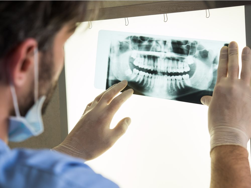 A panoramic dental X-ray shows the full mouth.