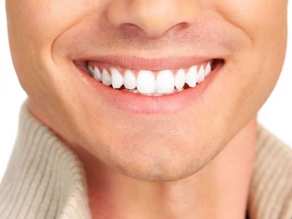 Estetik Diş Kaplama Nedir - Gülüş Estetiği Nasıl Yapılır 