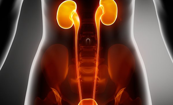 Kidney stones are treated by passing naturally, with ESWL, PCNL or using a ureteroscope to remove them.
