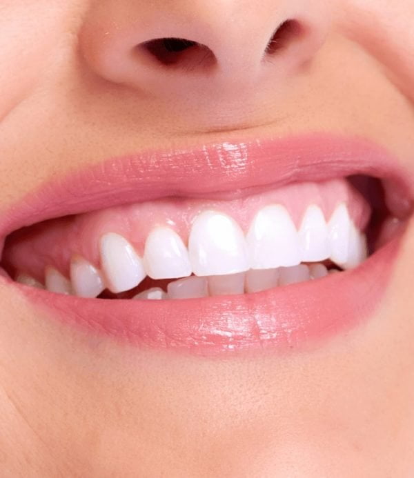 Scaling and root planing can help to reduce the presence of gum disease.