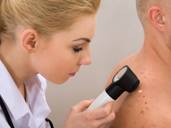 The skin is examined by a dermatologist or doctor and the they will then prepare for the biopsy.