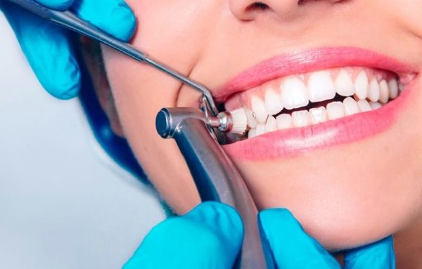 Dentists recommend a professional clean every 6 months.