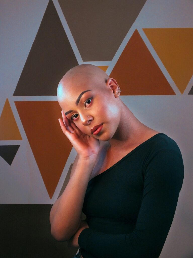alopecia donne trapianto di capelli
