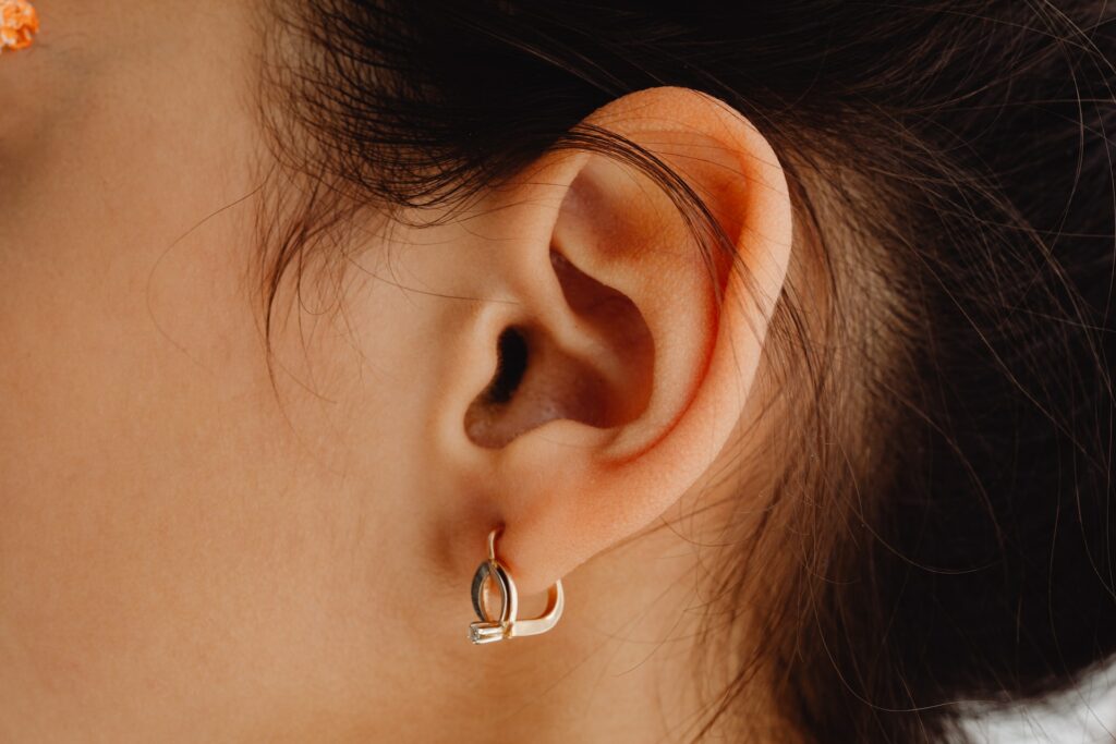 intervento di otoplastica orecchio