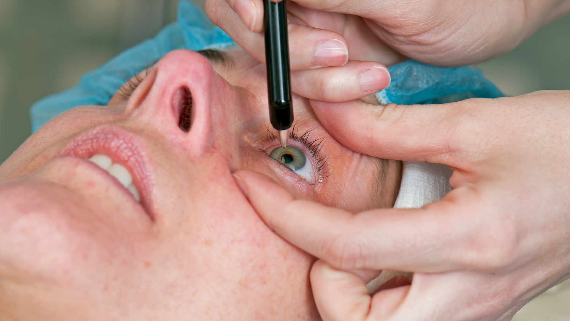 medico controlla occhio prima di procedura lasik