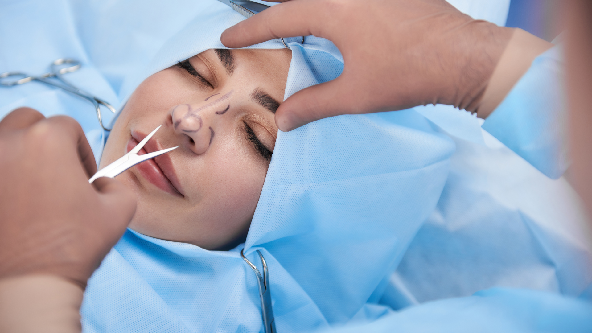medico inizia operazione di rinoplastica punta del naso grossa