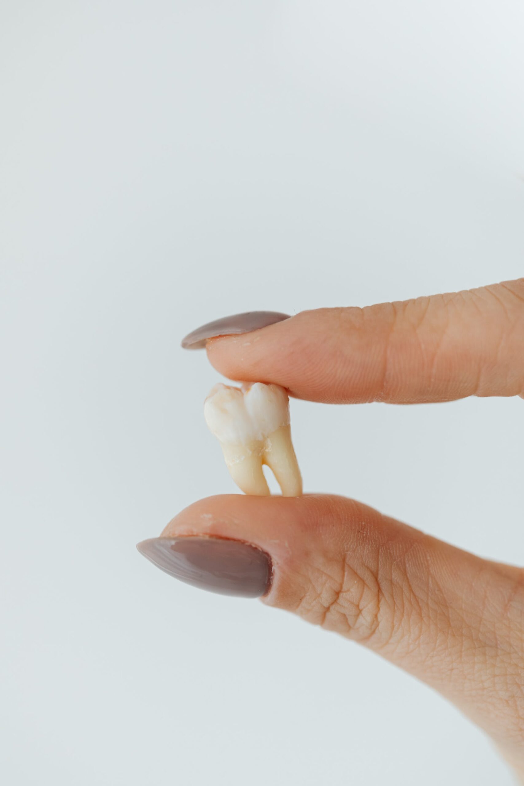 anatomia dente costo devitalizzazione
