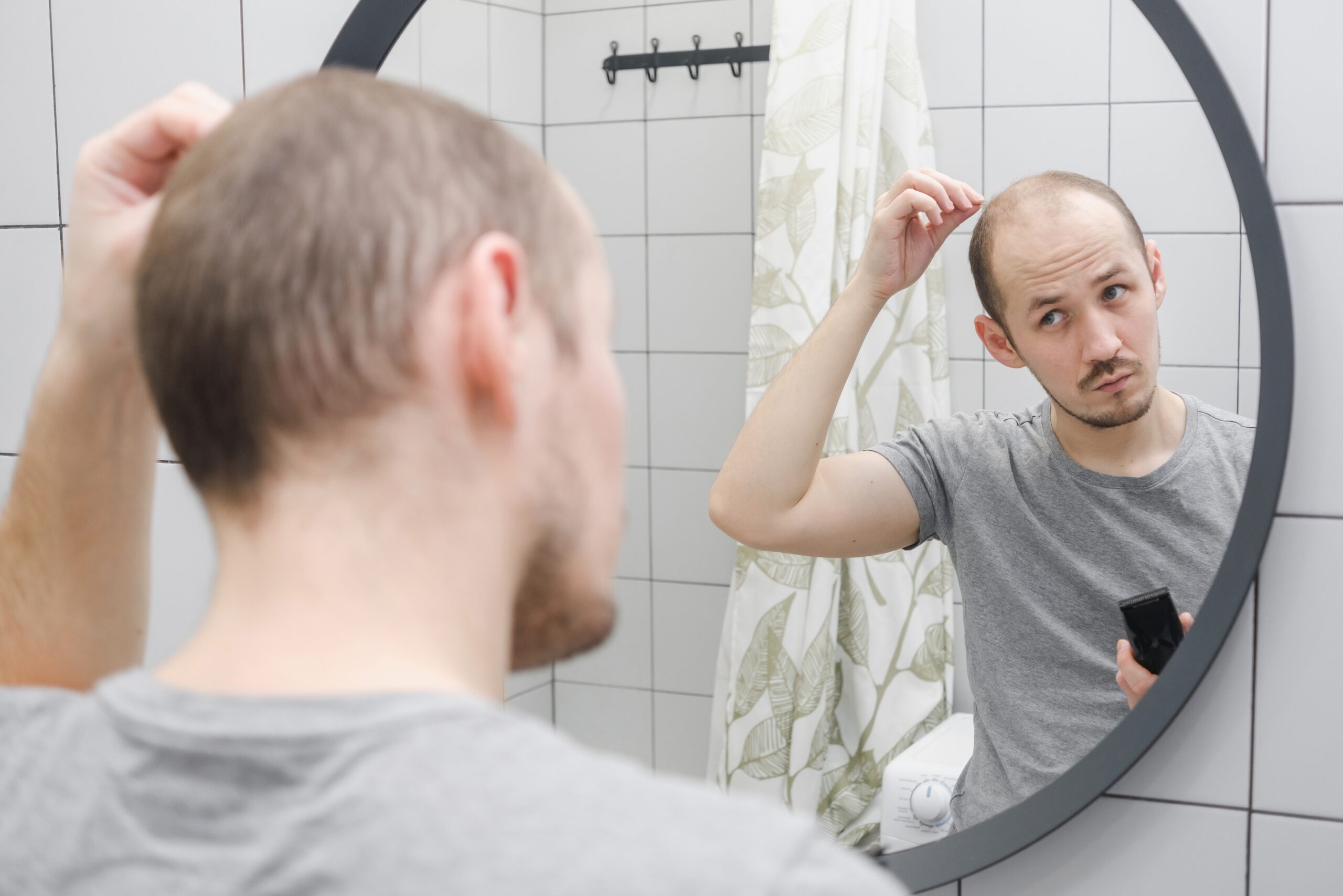 uomo che si guarda allo specchio con alopecia da stress
