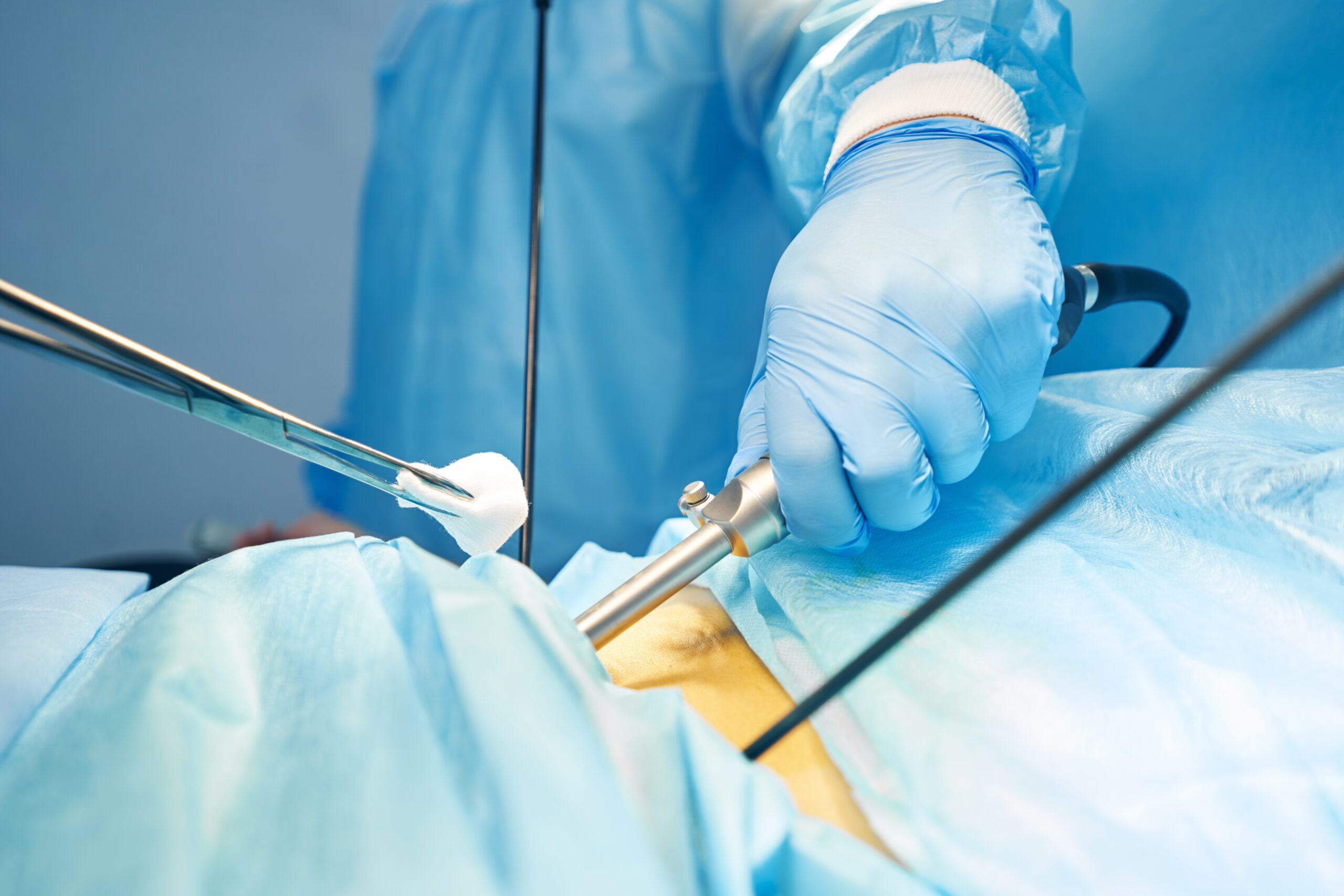 medici che fanno sleeve gastrectomy